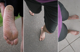 Barefoot Running