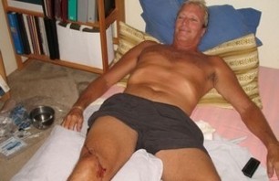Shark attacks Hawaii surfer